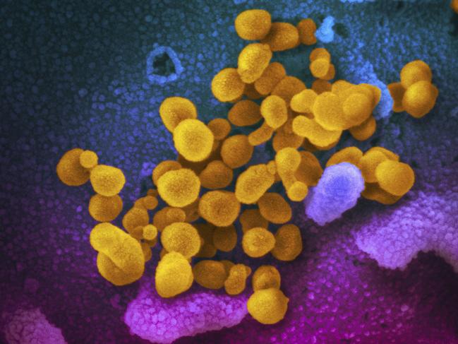 Electron microscope image made available by the US National Institutes of Health in February 2020 shows the Novel coronavirus SARS-CoV-2, yellow, emerging from the surface of cells, blue/pink, cultured in the lab. Picture: AP, File