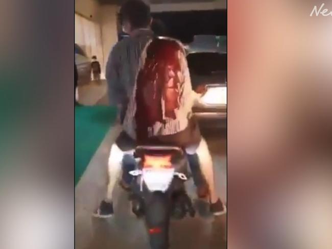 The Australian man bleeding at the back of a scooter.