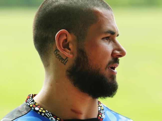 Nathan Peats during the launch of Parramatta's first indigenous jersey at Parramatta Park, Sydney. Scar on Nathan's neck where he had surgery. Pic Brett Costello