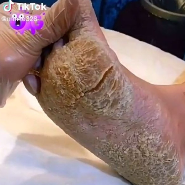 Gross moment beautician shaves off mountains of dry skin on client's feet, video