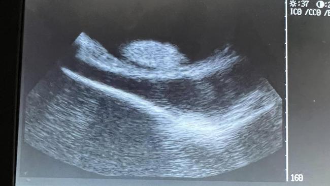 An ultrasound confirmed Charlotte's shock pregnancy. Picture: Aquarium &amp; Shark Lab / Facebook