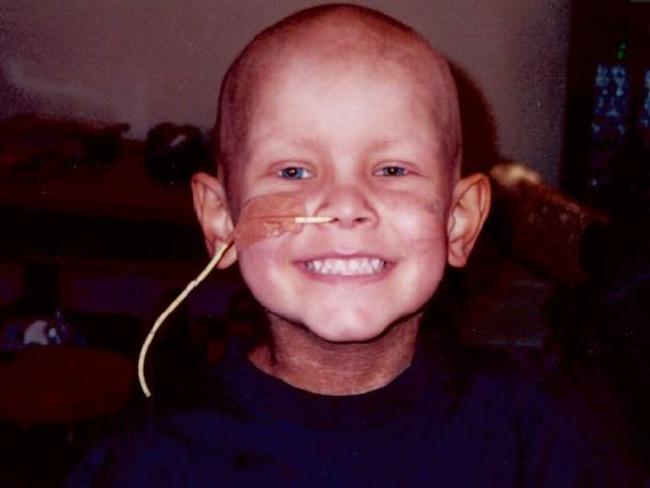 Putting on a brave face: Joseph Giffin undergoing treatment for a rare type of cancer.