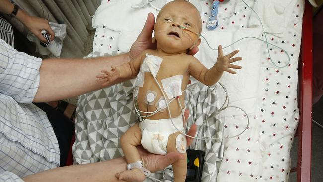 Baby Gus Rule, 11 weeks, suffered heart failure in the womb. Gus is held by his father John as monitor wire sand sensors are attached to his little body. Picture: David Caird.