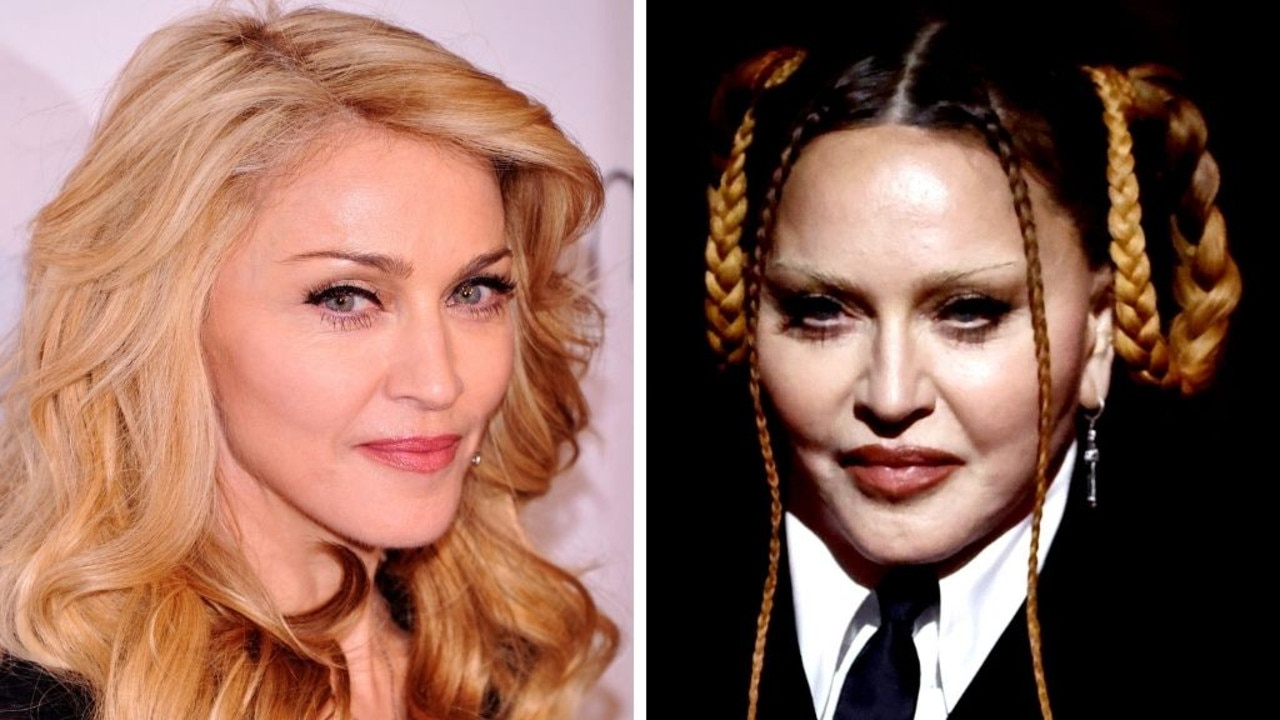 Madonna admits to plastic surgery after that unrecognisable appearance at  Grammys