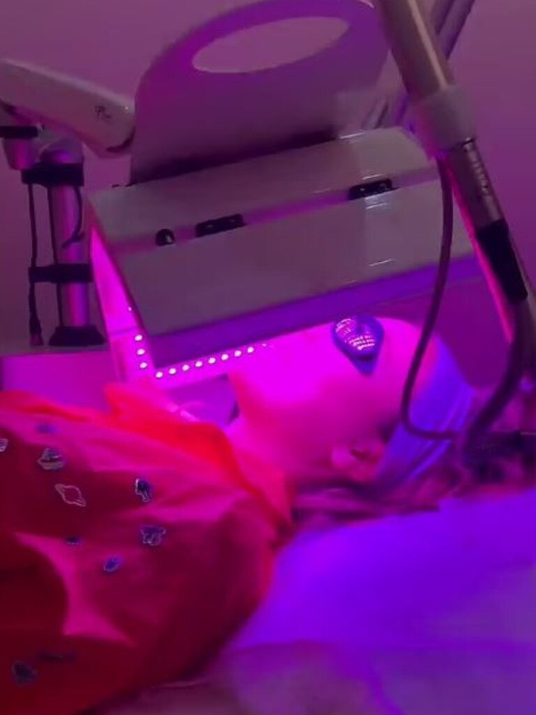 She also shared video of her undergoing LED light therapy to treat her breakouts. Picture: Instagram/Nadia Bartel.