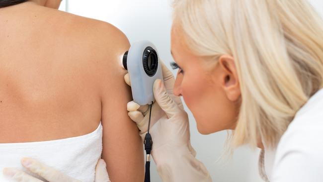 A link has been found between melanoma and auto-immune disease.