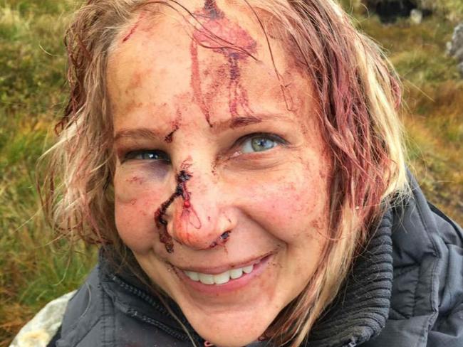 ONE TIME WEB USE ONLY - FEE APPLIES FOR REUSE - Magdalena Michalowska tumbled 15 metres (50ft) from a rock face on Stob Garbh near Stirling, Scotland. Picture: Deadline News