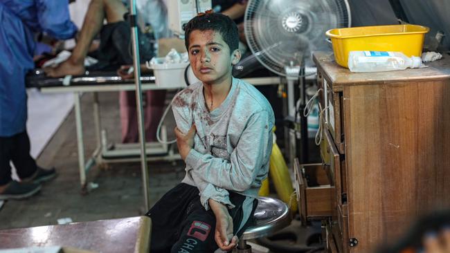 An injured Palestinian boy awaits treatment at the Kuwaiti hospital following Israeli strikes in Rafah on Tuesday. Picture: AFP