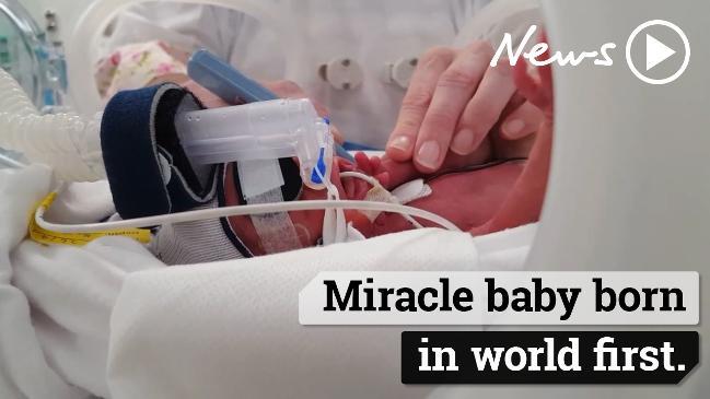 Baby born after mum needs new lungs, heart and liver