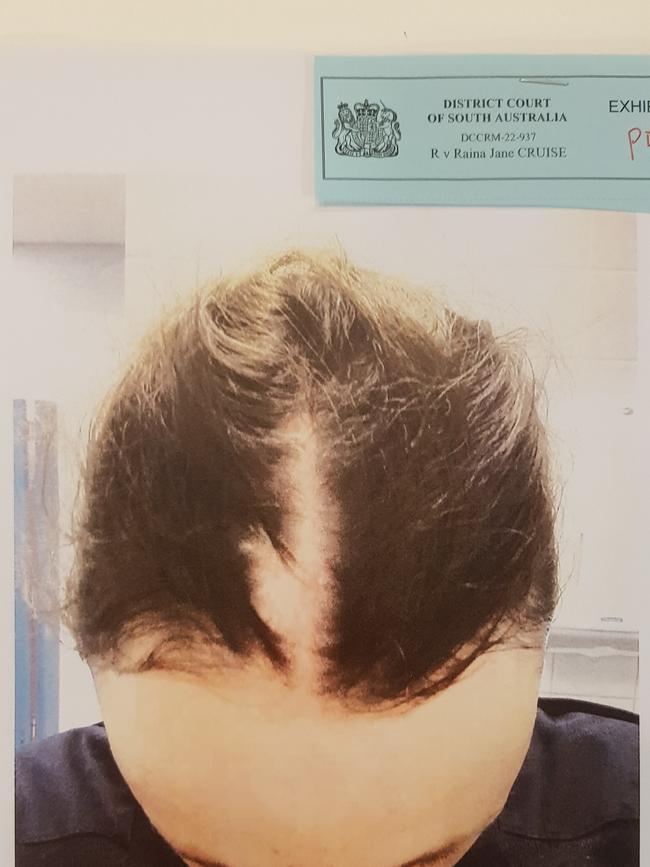 Injuries sustained by SA Police Constable Anthea Beck, allegedly inflicted by Raina Jane Cruise. Picture: District Court registry