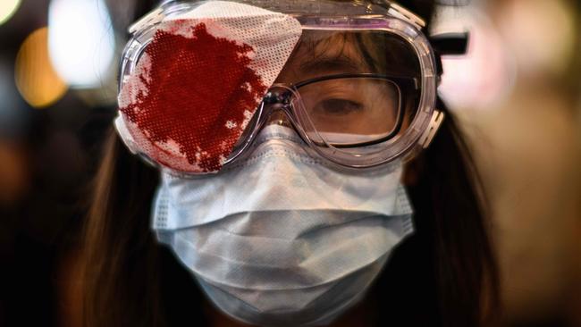 A demonstrator wearing a mock bloodied bandage over her eye. Picture: Anthony Wallace/AFP