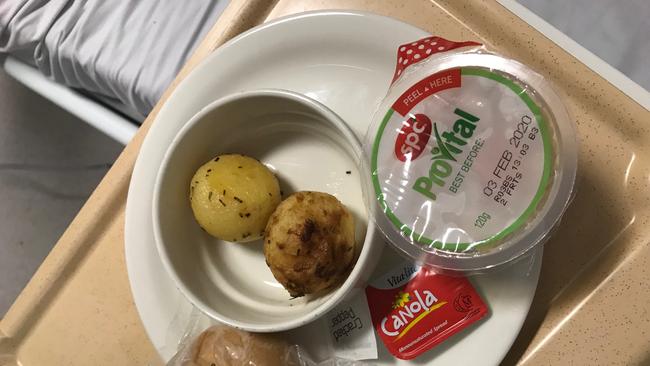 A vegan patients was given two boiled potatoes as a meal at the RAH.