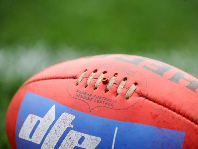 The Western Bulldogs are facing legal action over alleged historic sexual abuse.