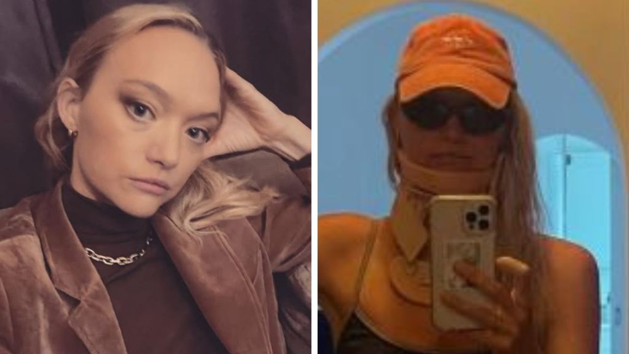 37yo supermodel’s shock injury reveal
