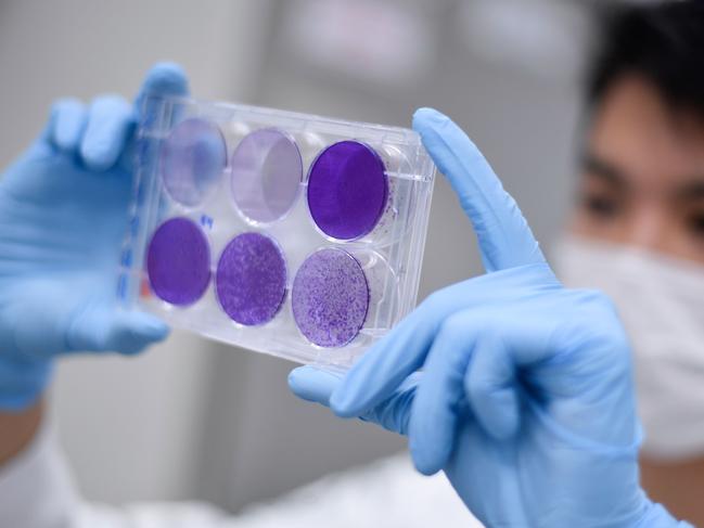 (FILES) In this file photo taken on March 26, 2020 a researcher works on virus replication in order to develop a vaccine against the coronavirus COVID-19, in Belo Horizonte, state of Minas Gerais, Brazil, on March 26, 2020. - Brazil said on June 27, 2020 it had reached a deal to produce up to 100 million doses of the coronavirus vaccine being developed by Oxford University, which the country is helping to test. The vaccine, which Oxford is working on with pharmaceuticals group AstraZeneca, is one of the most promising of the dozens that researchers worldwide are racing to test and bring to market. (Photo by Douglas MAGNO / AFP)