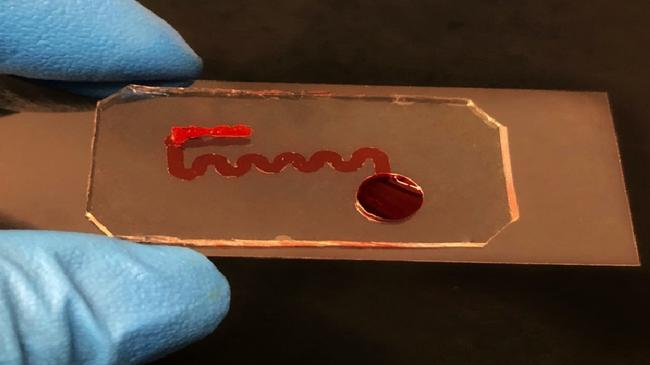 The microfluidic cell culture chip developed at UniSA closely mimics the structure and function of small blood vessels within a disposable device the size of a glass slide, allowing researchers and clinicians to investigate the impact of radiotherapy on the body’s tissues. Picture: UniSA