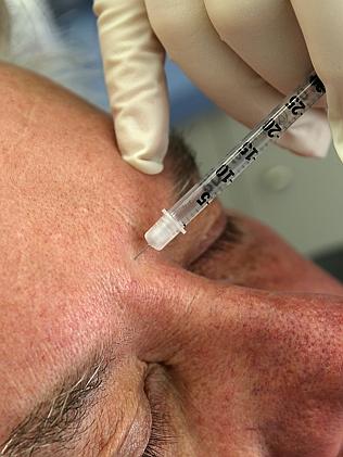 A man has a Botox treatment at The Aesthetic Laser Centre in Salamanca. 