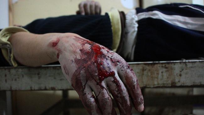 A wounded man lies inside a makeshift hospital in the rebel-held town of Douma, following air strikes by regime forces. Picture: Hamza Al-Ajweh/AFP