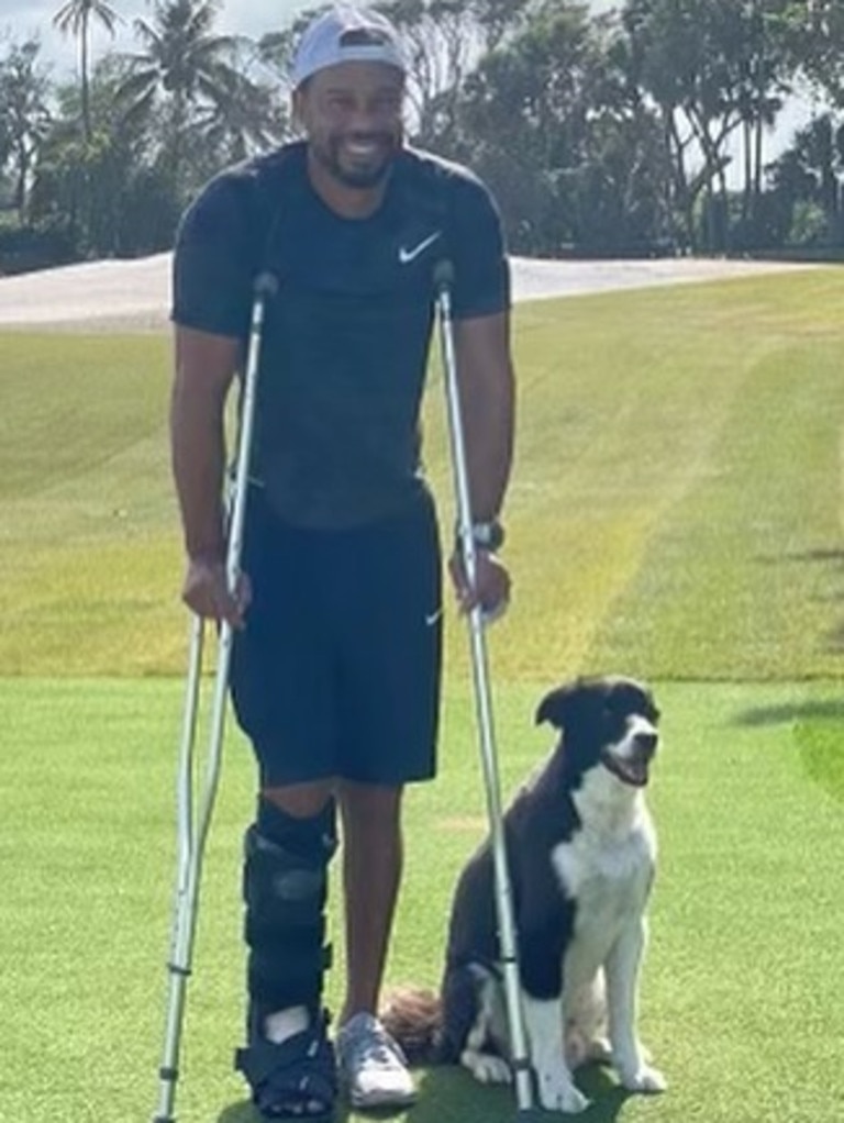 Tiger Wood's first photo since his horror car crash. Picture: Tiger Woods/Instagram