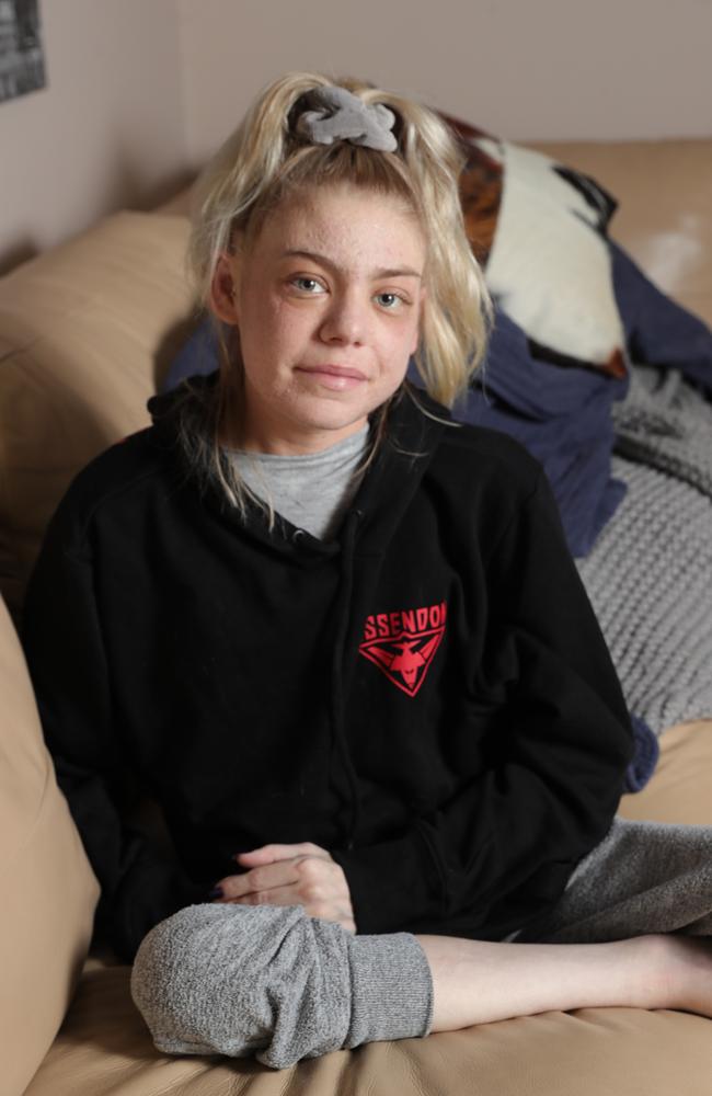 The 23-year-old was diagnosed with melanoma in June 2019. The cancer spread to her lungs, liver and chest. Picture: Glenn Hampson