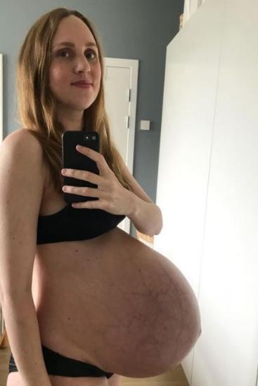 The story behind this woman's amazing 'baby bump'