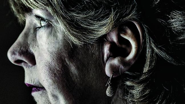 Colleen Murray, with her prosthetic ear. Picture: Julian Kingma