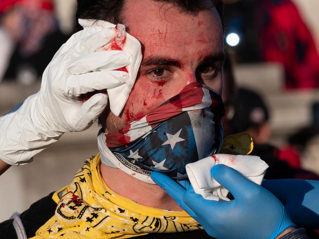 An injured supporter of US President Donald Trump is helped after being assaulted by an unknown assailant in Washington, DC. Picture: AFP