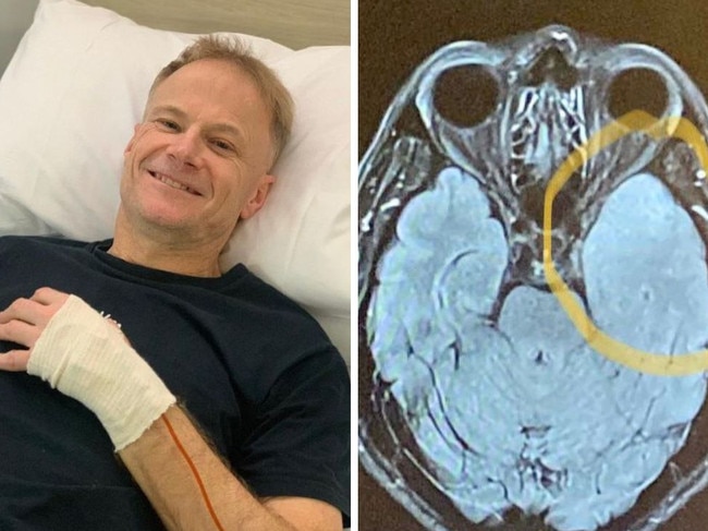 World-leading melanoma pathologist Professor Richard Scolyer is undergoing experimental treatment. Picture: Instagram@profrscolyer