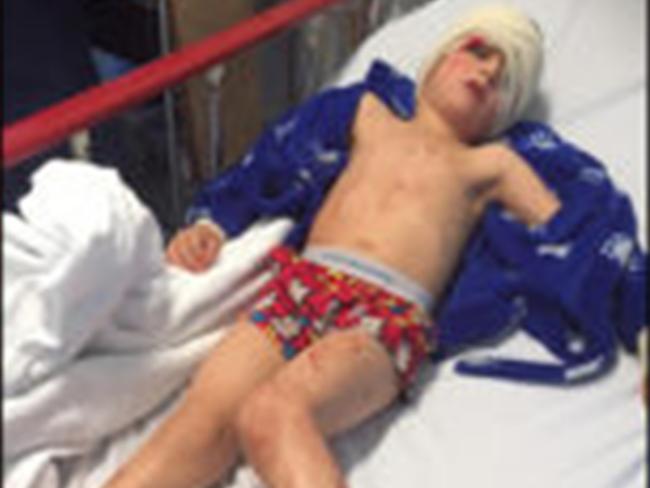 Megan Tilbury's four year old son was injured after their shower screen shattered. Picture: Supplied