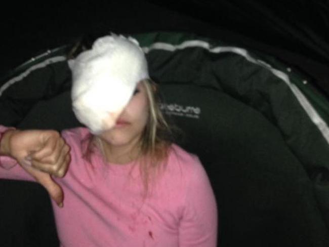 The incident happened while she was camping with friends.