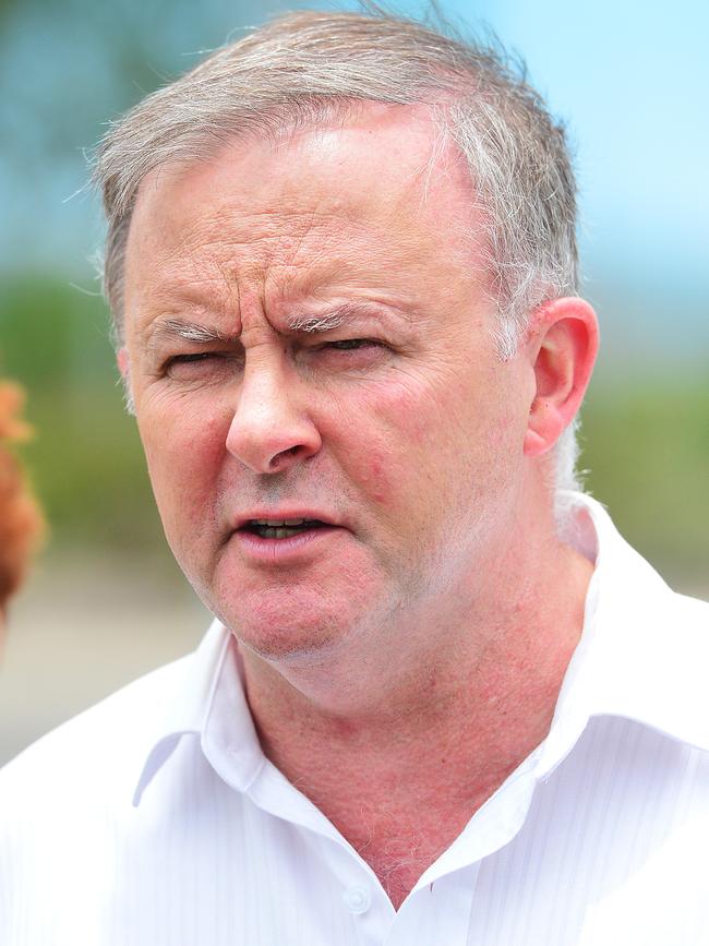 Anthony Albanese 