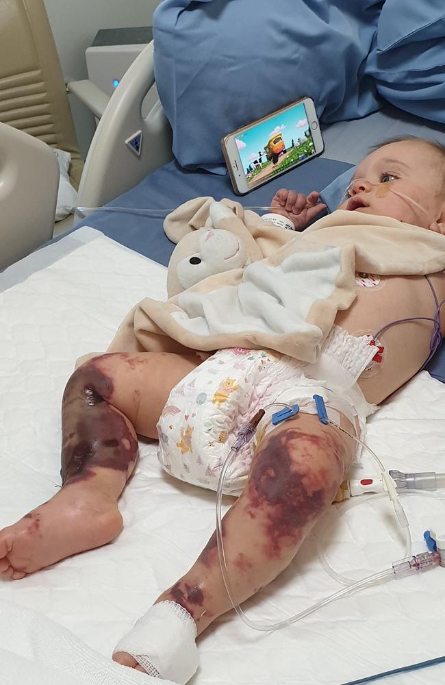 Baby Lilliana Sheridan has infections in both of her legs after contracting meningococcal while in Thailand on holiday with her Gold Coast family. They want to bring her home to Australia as Thai doctors talk about possible amputation.