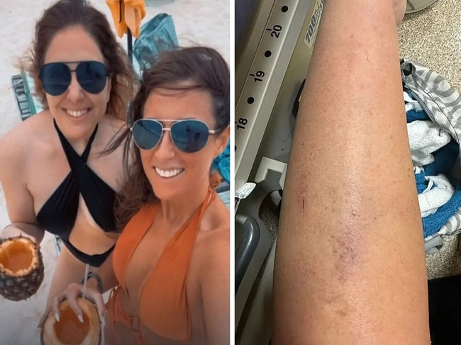 Mum’s haunting text after resort rape