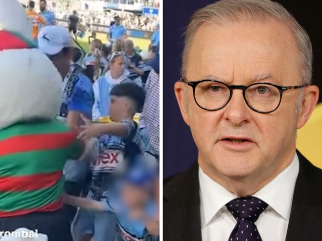 Anthony Albanese defended Rabbitohs mascot Charlie Gallico.