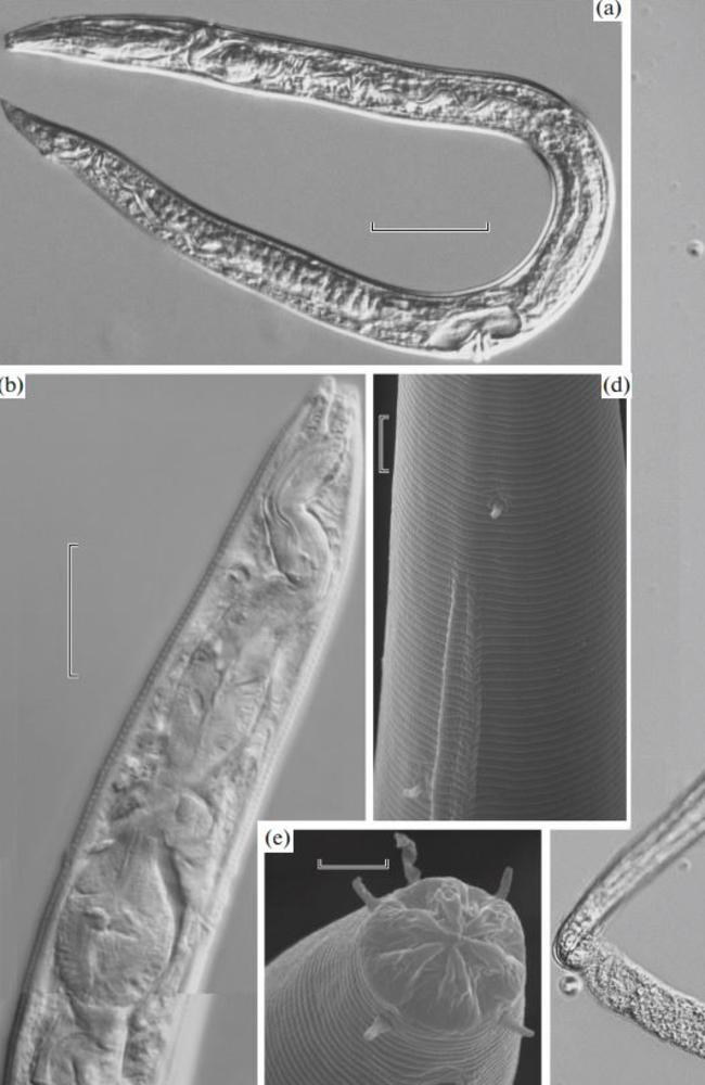 Microscope images of nematodes revived from the Siberian permafrost. Picture: Doklady Biological Sciences