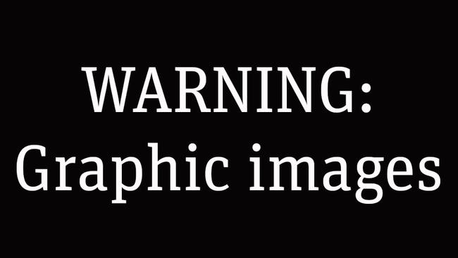 Warning: Graphic content.