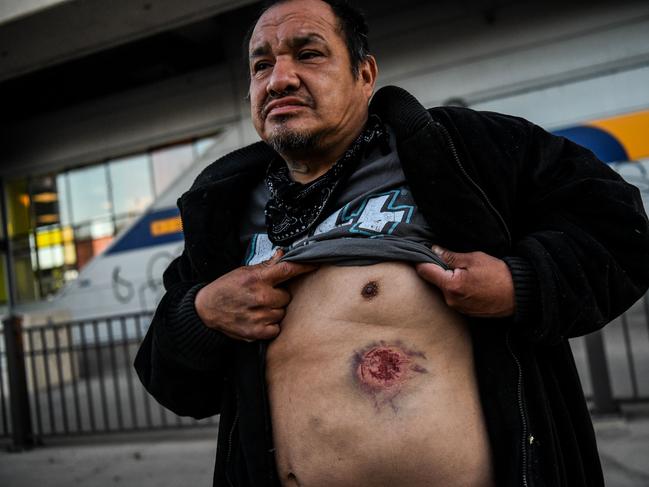 Boaz Brownader 46, shows a mark he says was caused by tear gas shell during a demonstration in Minneapolis, Minnesota. Picture: AFP