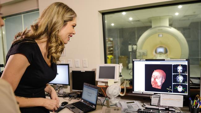 Moss witnesses the effect cyberhate had on her brain during an experiment.