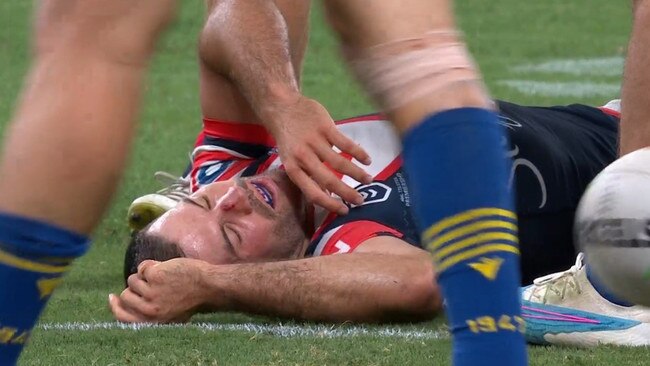 It was an ugly scene for James Tedesco. Photo: Fox Sports