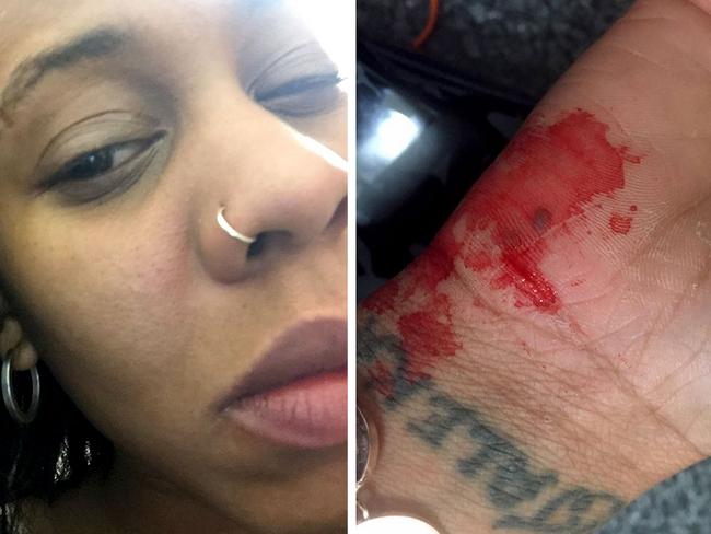 Uber driver ‘punched me in face’