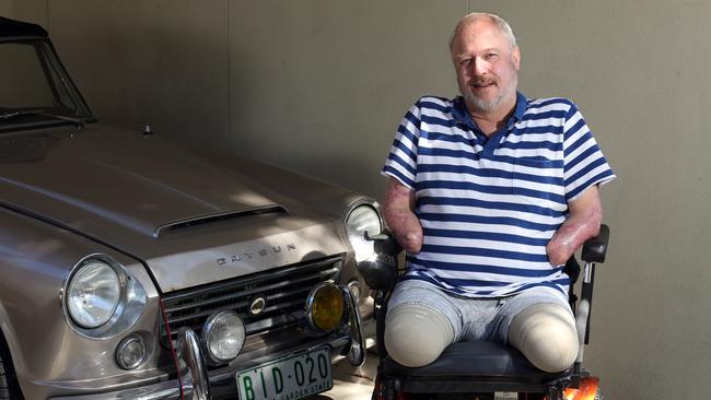 John Davey from Box Hill South lost his limbs to septicaemia. Picture: Stuart Milligan