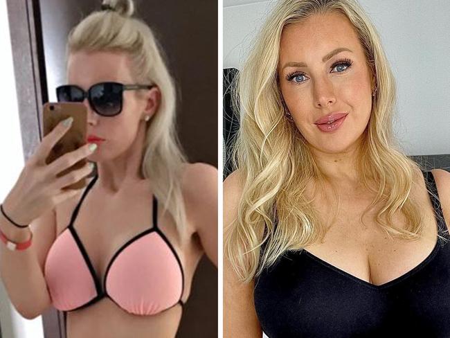 Woman obsessed with surgery reveals she’s happier ‘bigger’. Picture: Instagram/leah_jane___