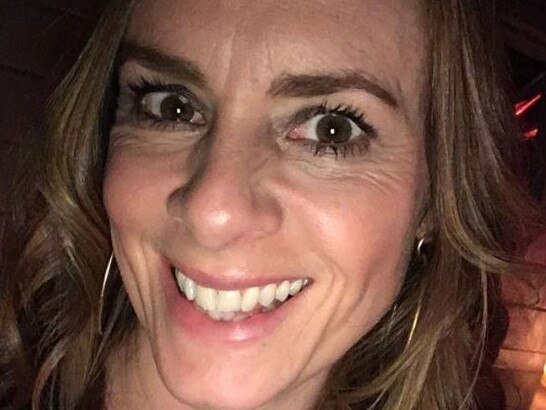 ONE TIME WEB USE ONLY - FEE APPLIES FOR REUSE - Mum left with ‘botched lip filler’ pout after allergic reaction to £60 teeth whitening kit she bought on FacebookClare Clark, 42, from Bristol spotted the special deal being offered by a beautician on Facebook. Picture: PA Real Life