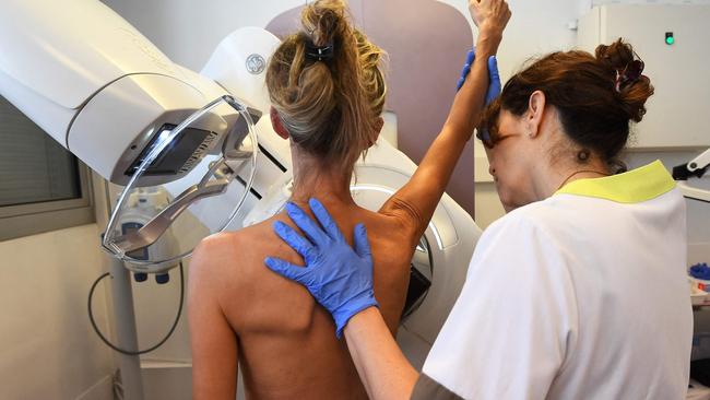 Only half of the people eligible to have breast mammogram screening did so in Victoria between 2020 and 2022. Photo: AFP