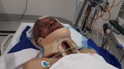 Sydney Ellis is in hospital after being savagely beaten outside Carrum Downs Plaza. Picture: Supplied