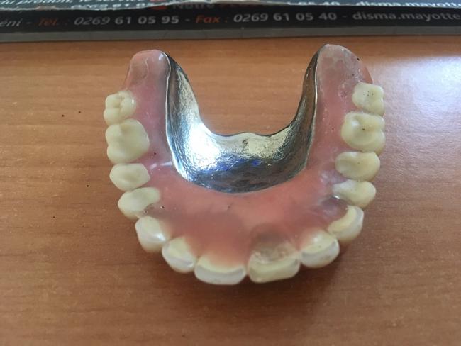 The dentures have the potential to be identified if they are from a passenger from MH370. Picture: Supplied