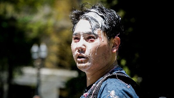 Journalist Andy Ngo after unidentified Antifa members attacked him during street protests on June 29, 2019 in Portland, Oregon. Picture: Moriah Ratner/Getty Images