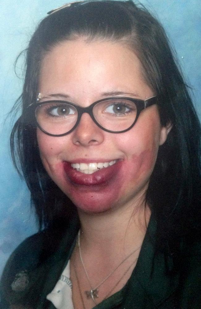 Tamara was nicknamed ‘Lippy’ at school and constantly bullied. She’s now embracing her condition, but says she is still bulled as an adult. Picture: Caters News.