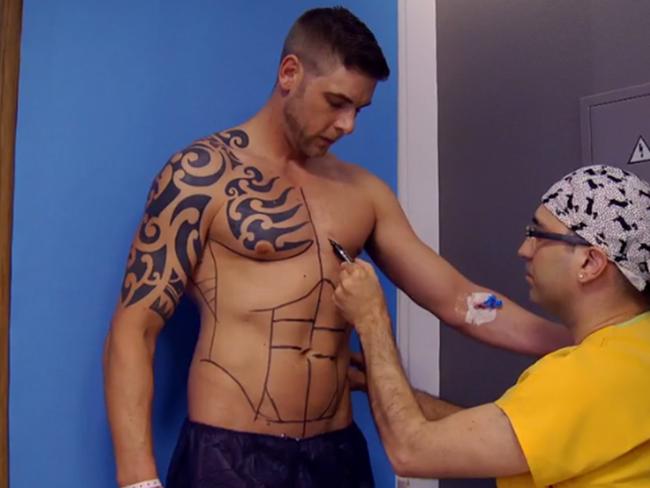 Lee Coupland in the lead up to the ‘abdominal etching’ procedure. Picture: BBC