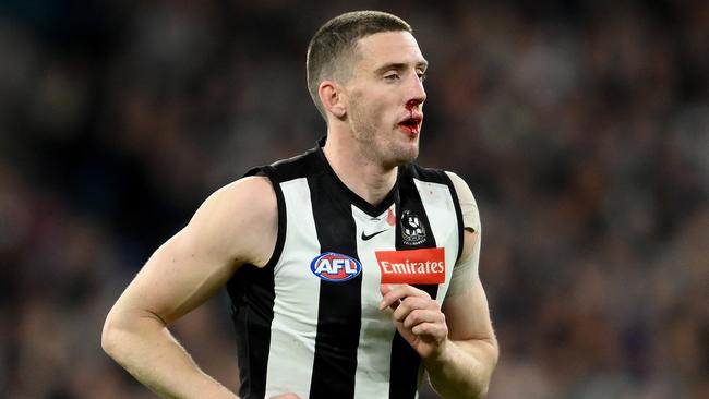 MELBOURNE, AUSTRALIA – SEPTEMBER 10: Darcy Cameron of the Magpies comes from the ground with a blood nose during the AFL First semi-final match between the Collingwood Magpies and the Fremantle Dockers at Melbourne Cricket Ground on September 10, 2022 in Melbourne, Australia. (Photo by Quinn Rooney/Getty Images)